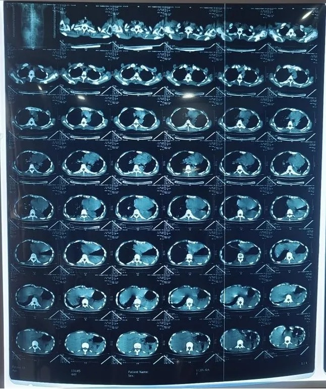 1720489513835962.jpg 3.jpg